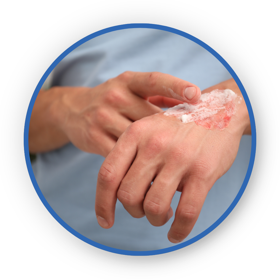 Addressing Complex Wound Environments with Advanced Materials